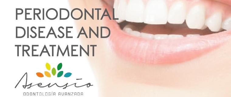 Gingivitis and Periodontitis