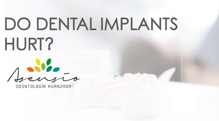 Dental Implants Hurt