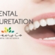 Dental Curettage