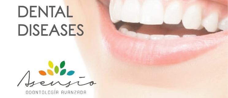 dental diseases