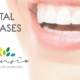 dental diseases