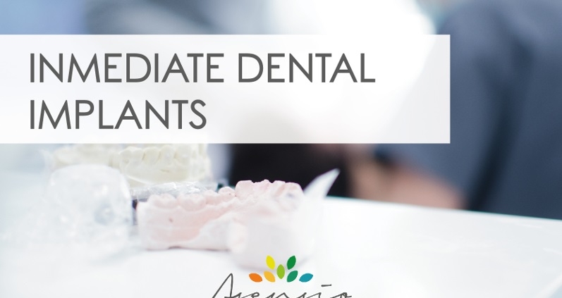 immediate dental implants