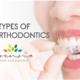 spian orthodontics