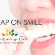 Snap on smile abroad