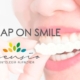 Snap on smile abroad