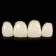 Composite Dental Veneers