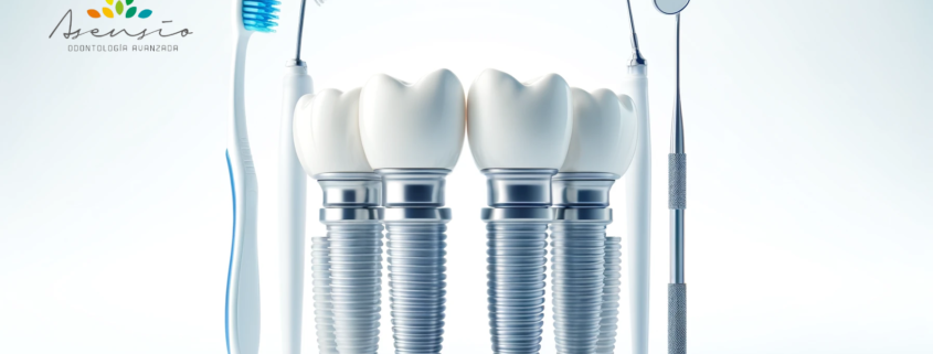 How to Clean All-on-4 Dental Implants