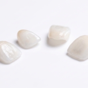 contact lens veneers price