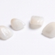 contact lens veneers price