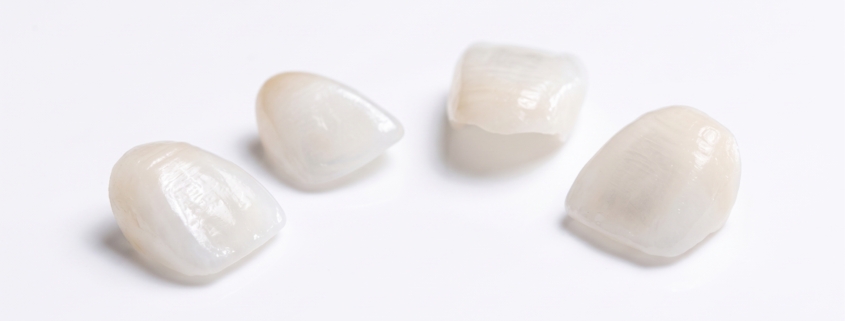 contact lens veneers price
